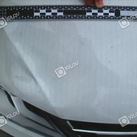 ��ʲô�������پ�ҽԺ���Ϲ������߱�ײ�ɣ���Ҫ��һ�����Σ�