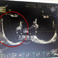 ���ˣ�������13����ŮС��¡��ҽԺ��鷢�֡�