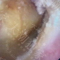 ���ˣ�����һ���Ӷ����ﳤ����ë��������Ϊ�����...