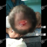 ��ȫ�����ټ�������ûͷƤ�����˸���Ժҽ��������ӡ��������