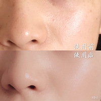 �������ֲ��Ƽ�������С��ƿ