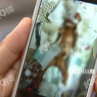 ��������1��6���ġ�Ĵָ�����������ˡ���ҽԺ������