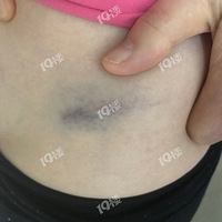 ���������豻��������С��ײ�ˣ��⳥ȴ����