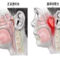 �������ݲ����棡���Ǻ��ӻ�С ���Ծ��ᵽ��Ӧ��Ӧ�ö�����...