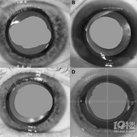 �������������� ������˾ƽ�����˹���״����ٴ�Ӧ�����