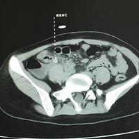 ������Ů��β�׷���ֻ����ҽ�����£����Ƕ����㡰�Ρ��ˣ�