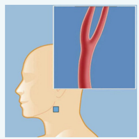 ���������Ʋ���Σ�����°�����Ŷ���ʱ�������ؽ�����·