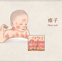 ��һ���� | ���¿����������������ô�죿