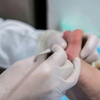 10���к�����Ӿ�νŵ׳���С����ҽ������Ⱦ��HPV