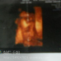 ����Ҫ�������Ӿ��ֲ���+�Ǻ�