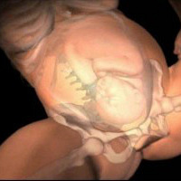 �и���Ȼ����ȫ��ͼ�⣨��������