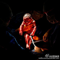 ��Ӱʦ���¸ճ����Ǽ���Ӥ������Ƭ���е�Ѫ�ȣ�ȴ���𺳣�