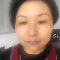 ����Ƥ�Ĵ���