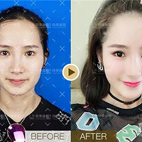 [ҽ������]����ͬ�������ͬ��֬��������ʡ��ָ�����ô����