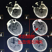 ���ô����׼�����£�������ȴͻȻ����һ�£�ҽ��˵���ǡ�