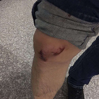 ����ץ��ʱ������Ѫ��Ҳ����һ��������ʱ��ȴ������Ϊ��