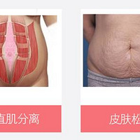 ���ɷ����޸���ֱ�������ݲ����޸�ר������һ����������