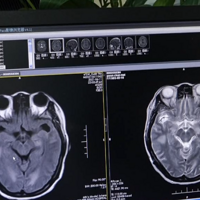 Ů�Ӱ��ɷ�ɱ����ʧȥ��ʶ����Щɥ����ҽ�����ⲡ�����ʸߴ�40