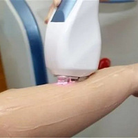 ���Ŵ������롢����Ѩ��������ë���������ϰ���Ƿ�ҽ�����飡