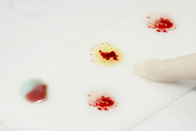 ����Ѫ���븸ĸ����ͬ������������