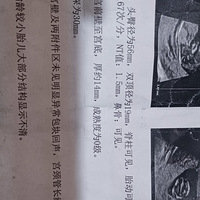 �������ڴ�+�������ռǣ�