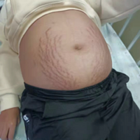 13��Ů������¡����������������CT�������ҽ�������ŵ���