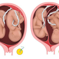 ���棡˫��̥����������ﾹ����������ģ��̲�ס����һ����һ��