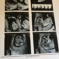 �ҵ�С��椡�2023�����ռǡ�