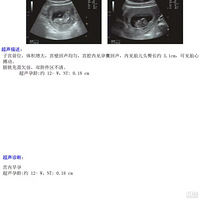 �ȴ���ä�е��ñ�