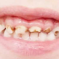 3�꺢������ȣ�ݣ�ԭ������ϰ���йأ����ǳ��ǣ�