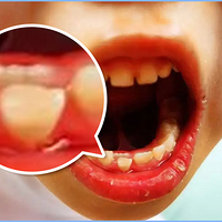 7��ǰһ����ע�����������û�û����ܶ��޷���ʱ����