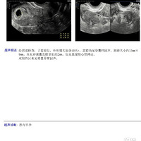 ��ʹС�ñ������������� [2023�����ռ�]