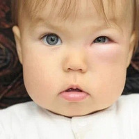 ���ӱ����Ӷ��������ִ�����������ʹ�����ظ��Ͼ���