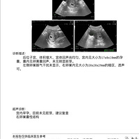 好了伤疤忘了疼的二胎妈妈+【2024孕妈日记】