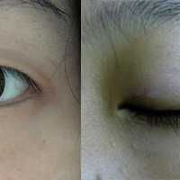 ���üٽ�ë ����ƤMM���������ؼ�