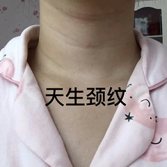 总算把颈纹搞了，记录3次嗨体注射的变化