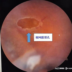 突发!古天乐眼睛问题曝光,惊人真相引发关注