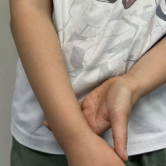 3岁儿子踉跄妈妈伸手拉回，孩子瞬间大哭 医生：这个动作高危！