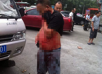 Ϊ2��Ǯ���� ���ֳ���ѳ˿Ϳ��û�����Ѫ��