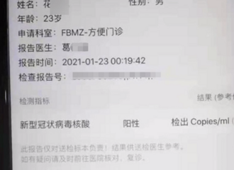 զ��ģ�����Ϊ�Ż����Ѹĺ����ⱨ�棬�����