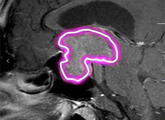 һ�곤35���ף�19���������߳���2��1��Ȼ����