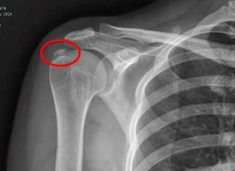 Ů�ӳ�����ҹ��ʹ�ѣ���˿�Ƽ��ҽ���������Ҽ缷�������ࡱ