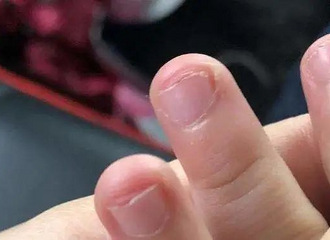 ����������9����ͯ�����ٽ�ָ��ҽ��������ϰ����������