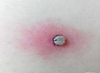 ̫���ˣ�9��Ů��ͷ�϶���š��롱���������Ǳ���Ѫһ������