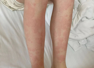 �����⡰���������㽭һŮ��ȫ���ܼ�������ҽ���ܶ��˶���