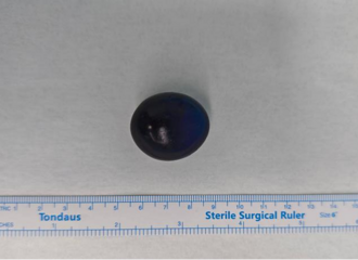 ��Ҫ�����Ͻ��ӣ�11�´���ͯ���������������ܶ�ҳ�����