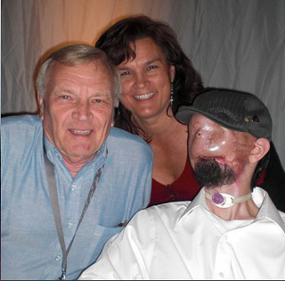 韦恩斯"换脸"手术前