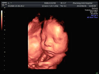 四维彩超五个月胎儿图图片