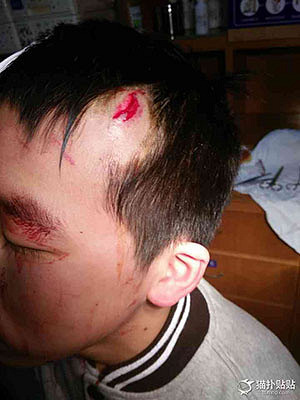 校园暴力再次升级,江山市中学铁榥伤人事件