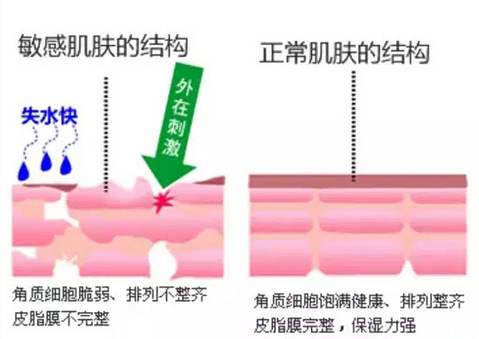敏感肌和激素脸,裸脸能好吗?